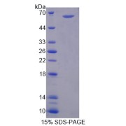 SDS-PAGE analysis of Peptidyl Arginine Deimina Type II Protein.