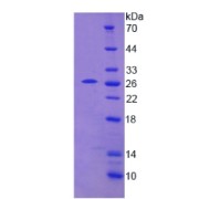 SDS-PAGE analysis of Thiopurine Methyltransferase Protein.
