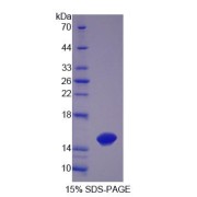 SDS-PAGE analysis of recombinant Human Trichohyalin Protein.