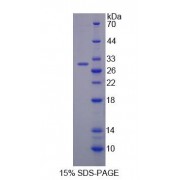 SDS-PAGE analysis of Biotinidase Protein.