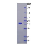 SDS-PAGE analysis of Glycyl tRNA synthetase Protein.
