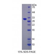 SDS-PAGE analysis of ATP Binding Cassette Transporter B5 Protein.