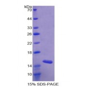 SDS-PAGE analysis of C-C Motif Chemokine 28 / CCL28 Protein.
