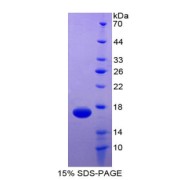 SDS-PAGE analysis of recombinant Human TEK Protein.
