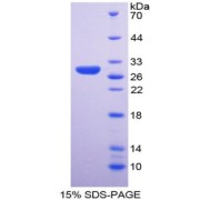 SDS-PAGE analysis of Ribonuclease P Protein.