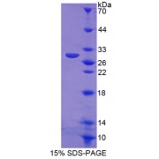 SDS-PAGE analysis of recombinant Human NOS2 Protein.