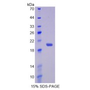 SDS-PAGE analysis of IL17RB Protein.