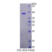 SDS-PAGE analysis of recombinant Human Keratin 6C Protein.