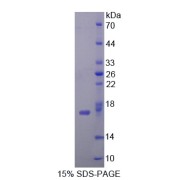 SDS-PAGE analysis of Cytidine Deaminase Protein.