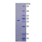SDS-PAGE analysis of recombinant Human GM2 Ganglioside Activator Protein.