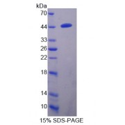 SDS-PAGE analysis of recombinant Human Transmembrane Protease, Serine 4 (TMPRSS4) Protein.