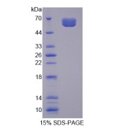 SDS-PAGE analysis of IL20RA Protein.