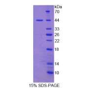 SDS-PAGE analysis of Absent In Melanoma 2 Protein.