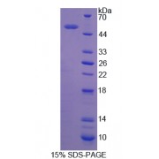 SDS-PAGE analysis of Rho GDP Dissociation Inhibitor beta Protein.