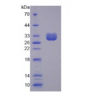 SDS-PAGE analysis of Human LRH1 Protein.