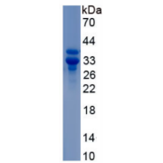SDS-PAGE analysis of Calponin 2 Protein.