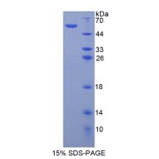 SDS-PAGE analysis of Matrix Metalloproteinase 15 Protein.