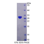 SDS-PAGE analysis of Pyruvate Dehydrogenase Complex Component X Protein.