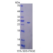 SDS-PAGE analysis of Ribonuclease A11 Protein.