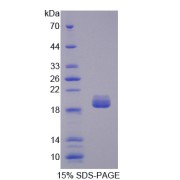 SDS-PAGE analysis of recombinant Human Topoisomerase III Protein.