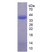SDS-PAGE analysis of Asparagine synthetase Protein.