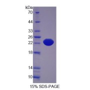 SDS-PAGE analysis of IL21R Protein.
