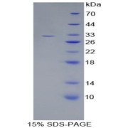 SDS-PAGE analysis of Complement Component 1, S Subcomponent Protein.