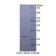 SDS-PAGE analysis of PPARG Protein.