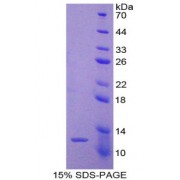 SDS-PAGE analysis of Peroxisomal Biogenesis Factor 2 Protein.