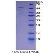 SDS-PAGE analysis of Proteasome 26S Subunit, Non ATPase 13 Protein.