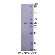 SDS-PAGE analysis of Minichromosome Maintenance Deficient 5 Protein.