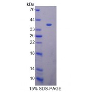 SDS-PAGE analysis of Breast Carcinoma Amplified Sequence 3 Protein.