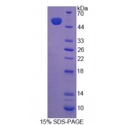 SDS-PAGE analysis of Coenzyme Q10 Homolog B Protein.