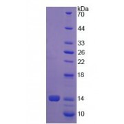 SDS-PAGE analysis of recombinant Human Procollagen Lysine-1,2-Oxoglutarate-5-Dioxygenase 1 Protein.