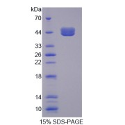 SDS-PAGE analysis of Transcobalamin I Protein.