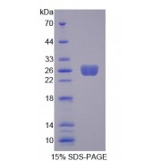 SDS-PAGE analysis of Tumor Necrosis Factor Ligand Superfamily, Member 9 Protein.