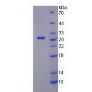 SDS-PAGE analysis of Potassium Inwardly Rectifying Channel Subfamily J, Member 10 Protein.
