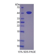 abx167034