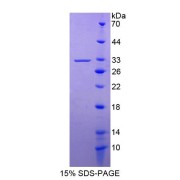 SDS-PAGE analysis of Kallikrein 13 Protein.