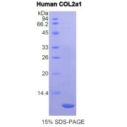 SDS-PAGE analysis of COL2A1 Protein.
