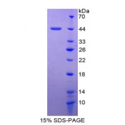 SDS-PAGE analysis of Serum Amyloid A4, Constitutive Protein.
