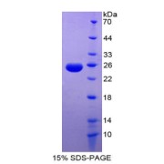 SDS-PAGE analysis of VEGI Protein.