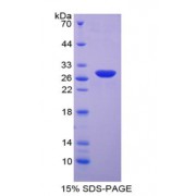 SDS-PAGE analysis of Neutrophil Cytosolic Factor 4 Protein.