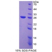 SDS-PAGE analysis of Nucleoporin 133 kDa Protein.