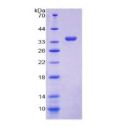 SDS-PAGE analysis of GDP Dissociation Inhibitor 1 Protein.