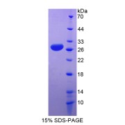 SDS-PAGE analysis of Apolipoprotein A4 Protein.