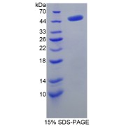 SDS-PAGE analysis of AHCY Protein.