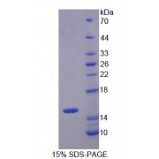 SDS-PAGE analysis of Organic Cation/Ergothioneine Transporter Protein.