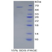 SDS-PAGE analysis of Acid Phosphatase 5, Tartrate Resistant Protein.