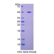 SDS-PAGE analysis of Lacritin Protein.
